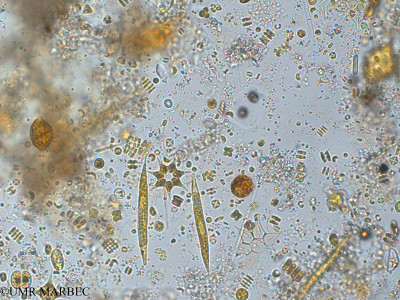 phyto/Pertuis Charentais/Tasdon_st2/PAMPAS 2019-2021/Willea rectangularis (old Crucigenia rectangularis -TASDON_St2_R1_0719001).tif(copy)_thumb.jpg